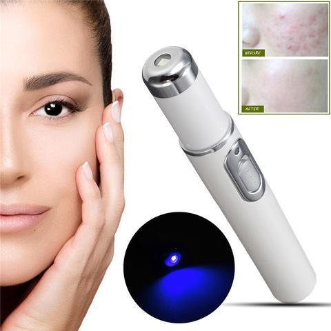 Blue Light Therapy Acne Laser Pen Scar Wrinkle Removal.