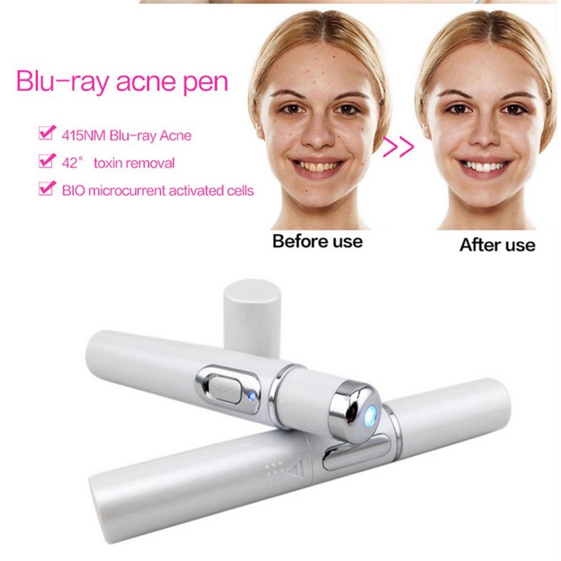Blue Light Therapy Acne Laser Pen Scar Wrinkle Removal.